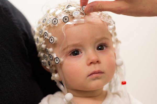 Baby with a hat filled with electrodes. 