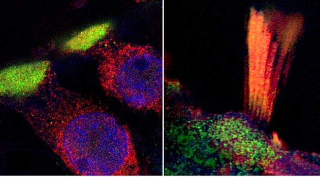 Super-resolution structured illumination microscopy (SR-SIM) show critical proteins in human hair cells associated with age-related hearing loss. 