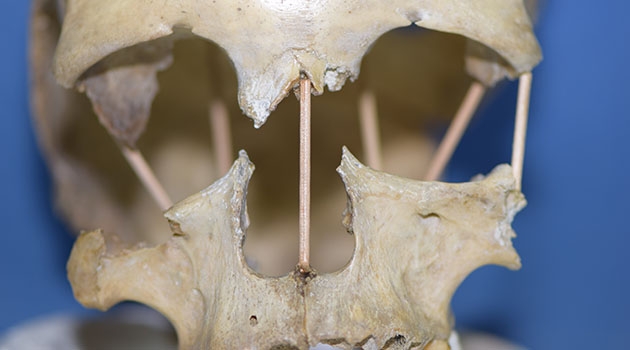 Genomet från skallbenen från kvinnan Peştera Muierii 1 visar att hon är en föregångare till de jägare-samlare-grupper som levde i Europa fram till istidens slut.