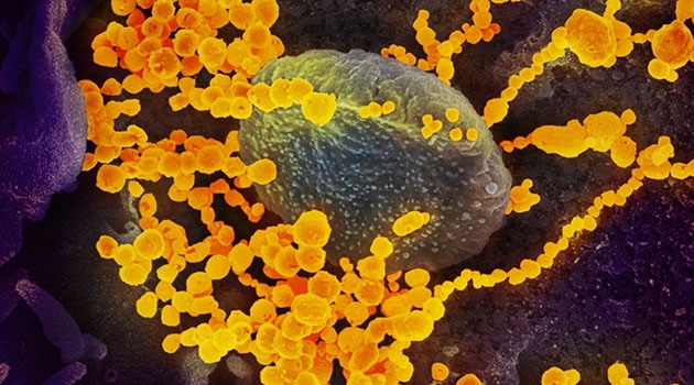 Bild tagen med svepelektronmikroskop visar viruset SARS-CoV-2 (gult).
