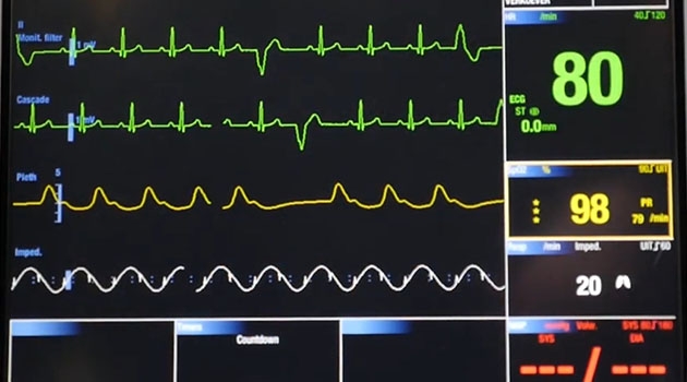 Artificiell intelligens kan användas inom vården för att få snabbare svar på EKG-mätningar.