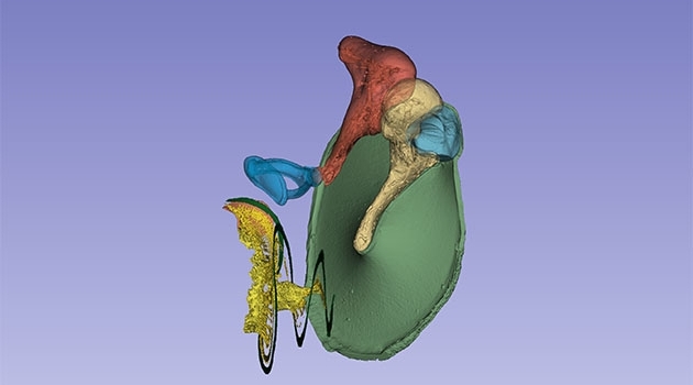 Tredimensionell bild av innerörat: Trumhinnan (grön) och hörselbenen hammaren (ljusgult) städet (orange) och stigbygeln (blå). Den gröna spiralen nedtill är hörselsnäckans hörmembran.