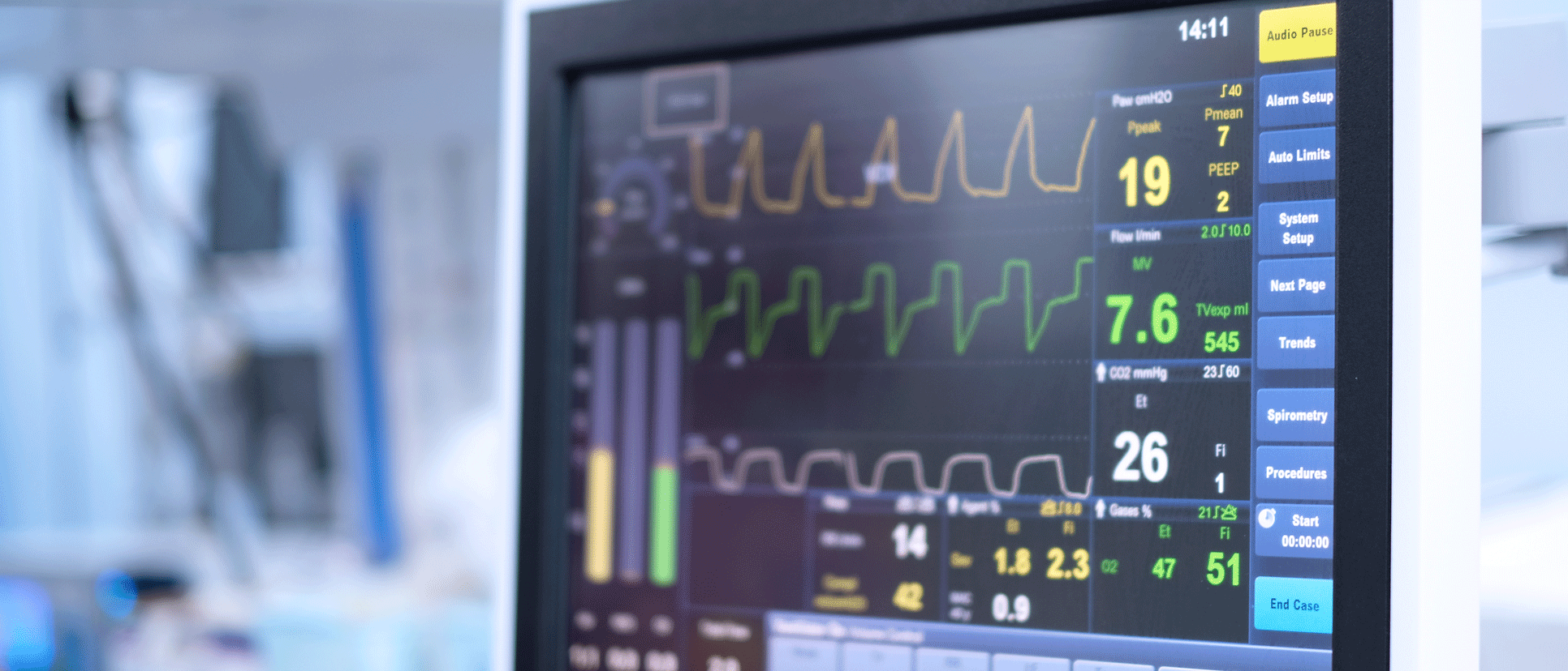 EKG-skärm i sjukhusmiljö