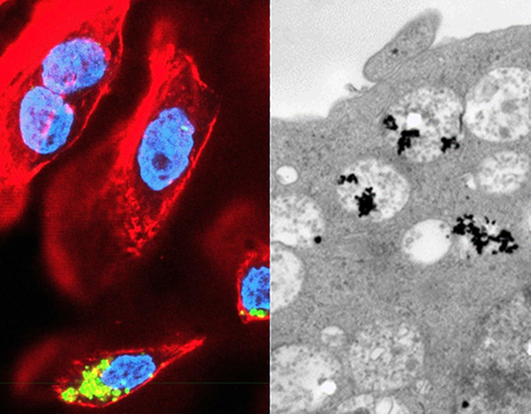 CRISPR/Cas-tekniken