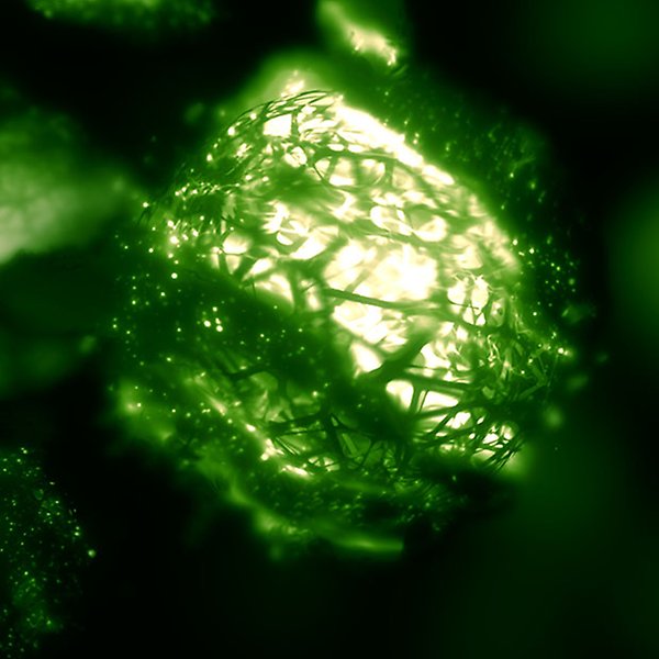 Makroförstoring av cyanobakterier i grönt.