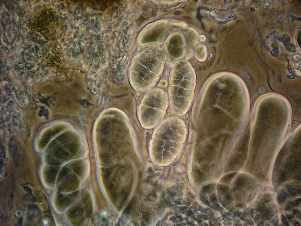 Organism sedd i ett mikroskop