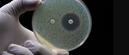 hand håller petriskål där bakteriestammar testas